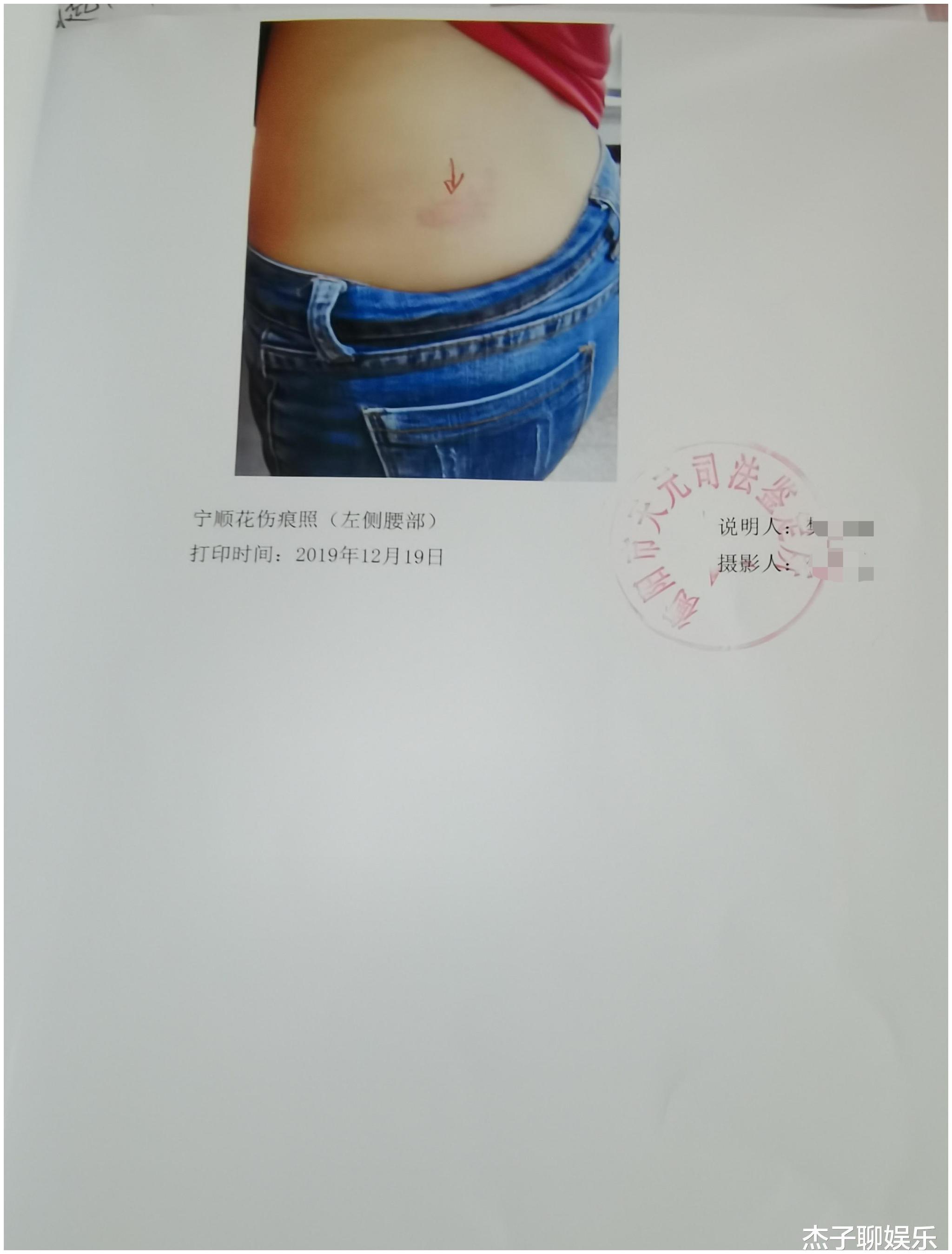 男方家暴嗜赌,女方5年4次起诉离婚,不料被法院一一驳回休闲区蓝鸢梦想 - Www.slyday.coM 男方家暴嗜赌,女方5年4次起诉离婚,不料被法院一一驳回休闲区蓝鸢梦想 - Www.slyday.coM