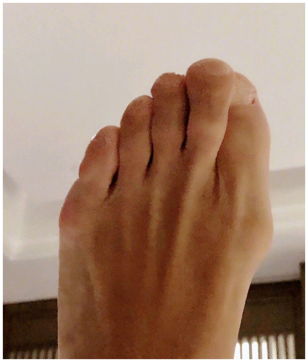 陈志朋凌晨三点晒照自称脚肿网友满屏脚臭味辣眼睛