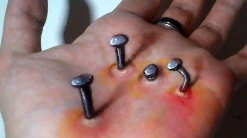 男子手上扎满钢钉却不去医院治疗知道原因后女友破口大骂