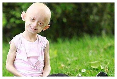 湖南女子生下"小猴子",丈夫崩溃不想要,宝妈的回应却太感人!