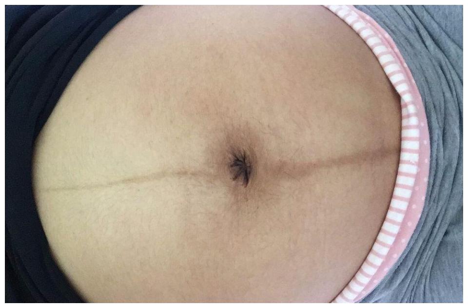 和之前没怀孕一样,但是在第七个月时,之前平平的肚脐居然"凸"出来了