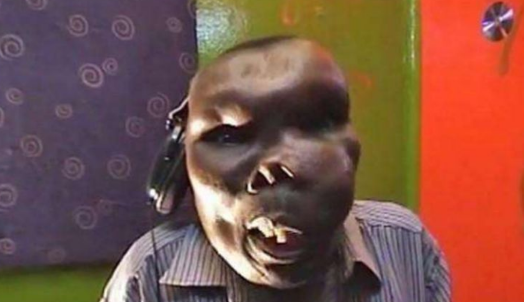 畸形男子遭人嫌弃,被人捧红后,娶上了美女媳妇令人看傻了眼!