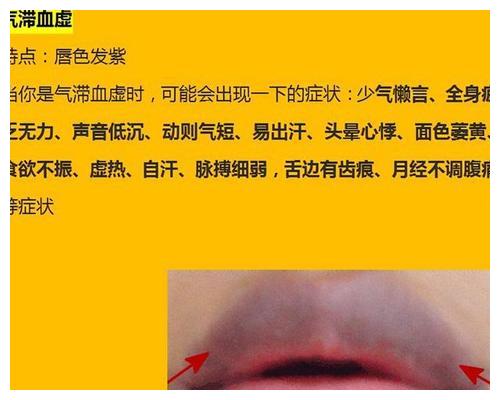通过唇色看脾胃!如果你的嘴唇出现这6种情况,可能就是脾虚了?
