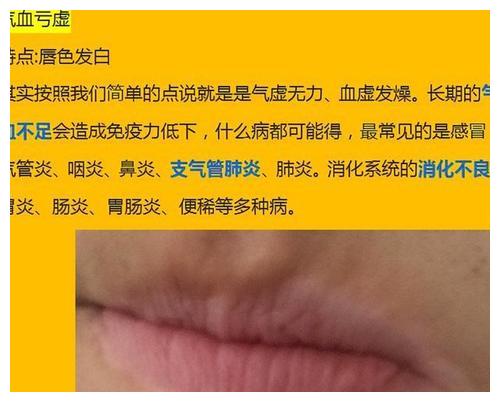 看我们嘴唇可以反应身体的病症,如果你的唇部是乌黑发紫,那么就是代表