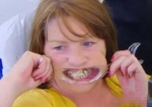 女子门牙掉了竟然用502强力胶粘上去，结果出人意料！休闲区蓝鸢梦想 - Www.slyday.coM