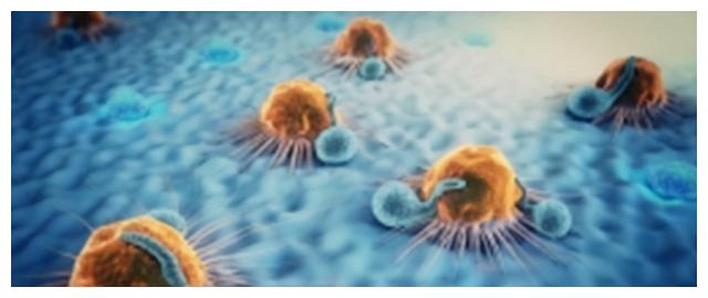 女子腰疼3个月,体检时发现体内长了肿瘤,这是为什么呢?休闲区蓝鸢梦想 - Www.slyday.coM 女子腰疼3个月,体检时发现体内长了肿瘤,这是为什么呢?休闲区蓝鸢梦想 - Www.slyday.coM