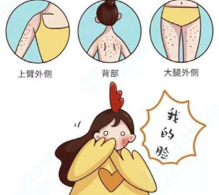 鸡皮疙瘩里面腿毛去除(腿上的鸡皮疙瘩怎么去除) 鸡皮疙瘩里面腿毛去除(腿上的鸡皮疙瘩怎么去除)