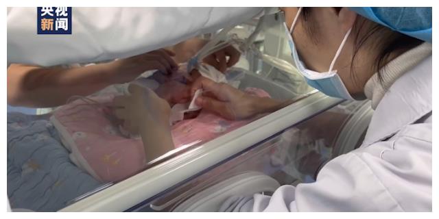 长沙一早产4个月婴儿被医护救下出生体重不到2斤