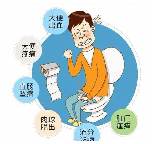 几个症状是痔疮的前兆__财经头条