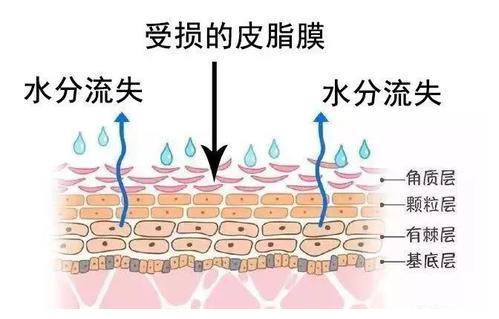 重庆新依美美肤皮肤屏障是什么受损如何修复