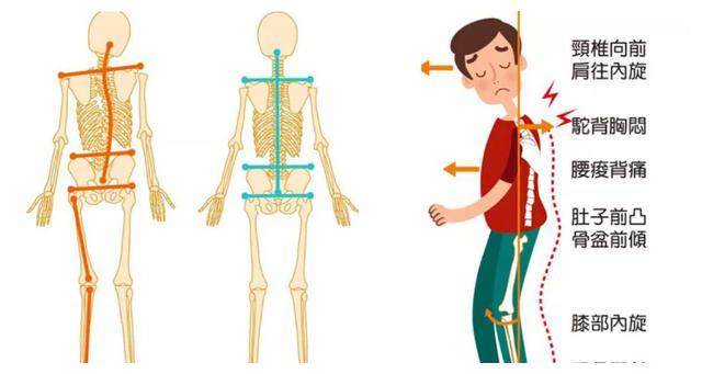经常葛优躺翘二郎腿孩子的脊柱正在悄悄发生变化