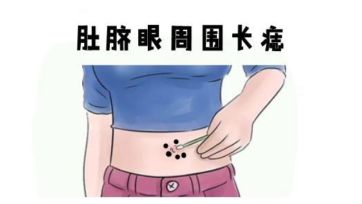 身体4颗吉痣易藏不易露,命里有黄金,抓住机会就大发|财运|福气|肚脐眼