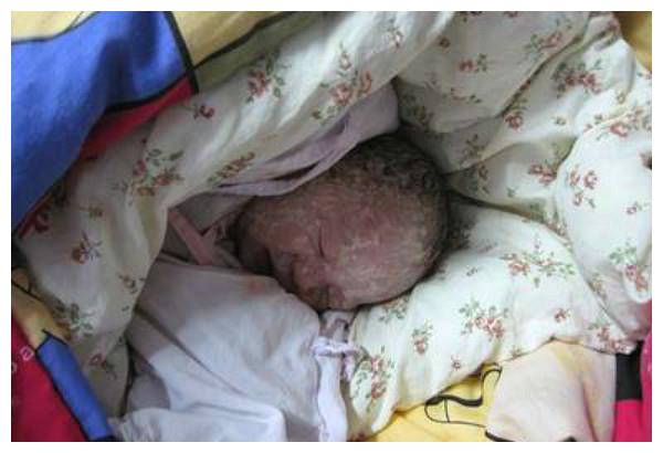 除了胎脂之外,很多父母会发现,刚出生的宝宝看起来泛紫,其实这是因为