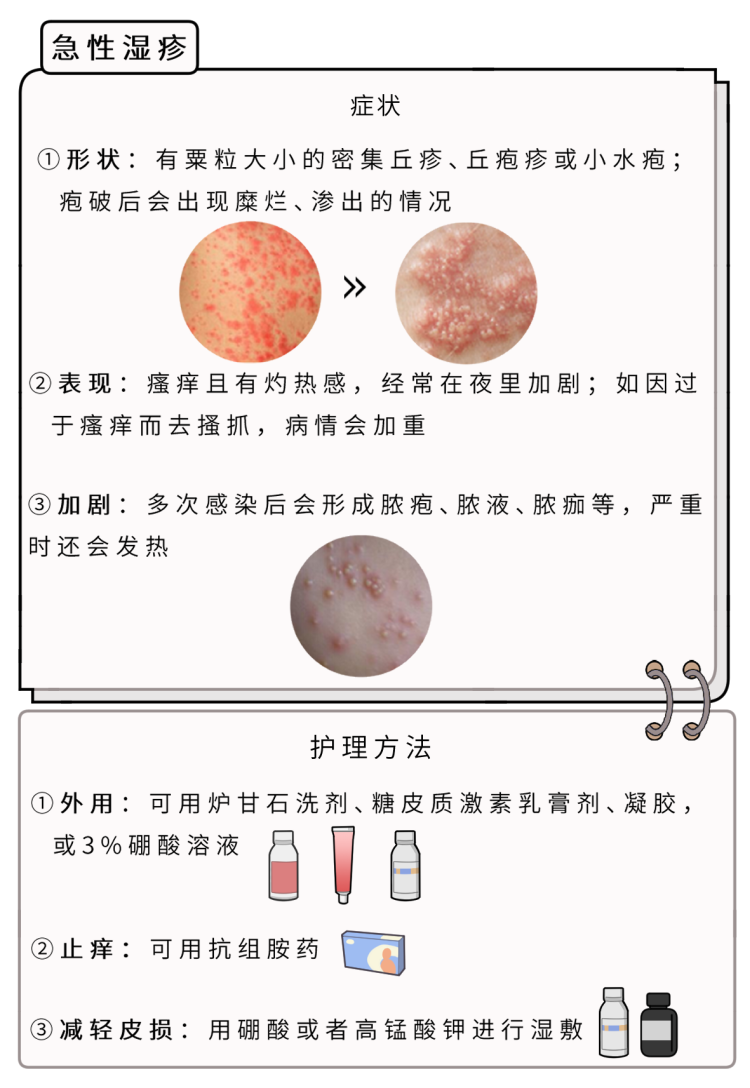 湿疹带状疱疹怎么治能好得快常见皮肤病用药指南来了