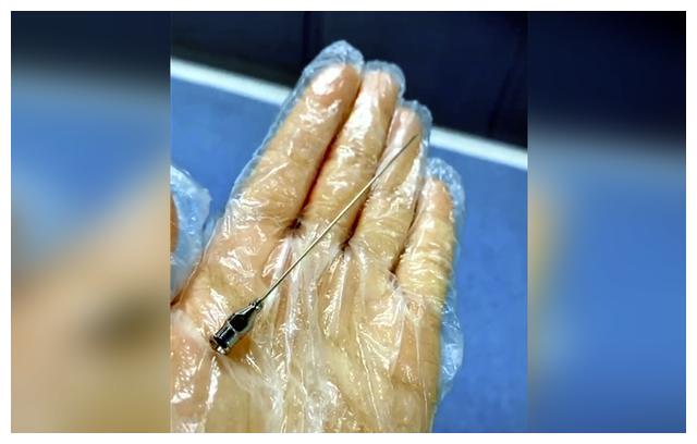 别天真了!第一步腰麻仅是遭罪的开始