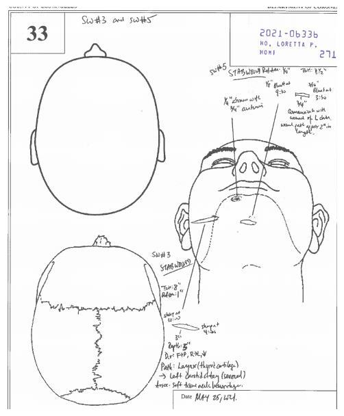 凶手太残忍钻石吧弑母杀弟案详细验尸报告曝光