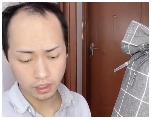 秃顶网红凭高颜值出圈与真明星同框后网友滤镜碎了