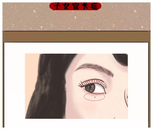 若是一个人的子女宫的位置长得凹陷有杂纹,恶痣等,则被称之为"劳碌痣"