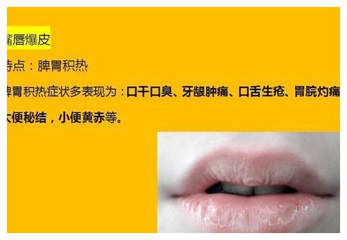 通过唇色看脾胃!如果你的嘴唇出现这6种情况,可能就是脾虚了?