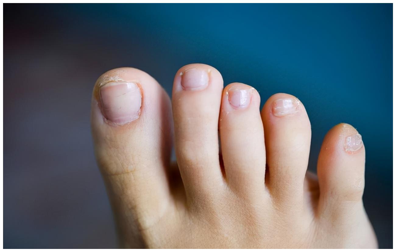 小脚趾的指甲长成两瓣，是纯种汉族人的证明？这种说法靠谱吗？_东方养生频道_东方养生