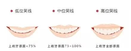 王一博生日上热搜，我却被他的笑容闪了眼，完美笑线就这么容易？__财经头条
