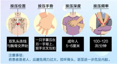 男子为老人做心肺复苏压断12根肋骨正确的心脏复苏方法分为4步