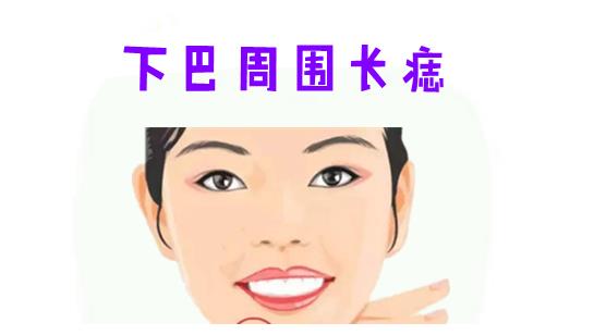 福禄痣,身体6大吉痣,命中显贵,升官发财快,中年必富