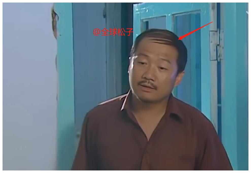 《乡村爱情》的剧组也是可能也是想到了这点,所以谢广坤的头发才愈发