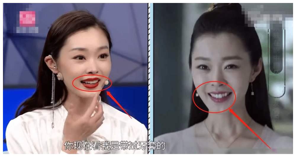 有种整容叫宋轶矫正牙齿后美到亲妈不敢认终于信了baby