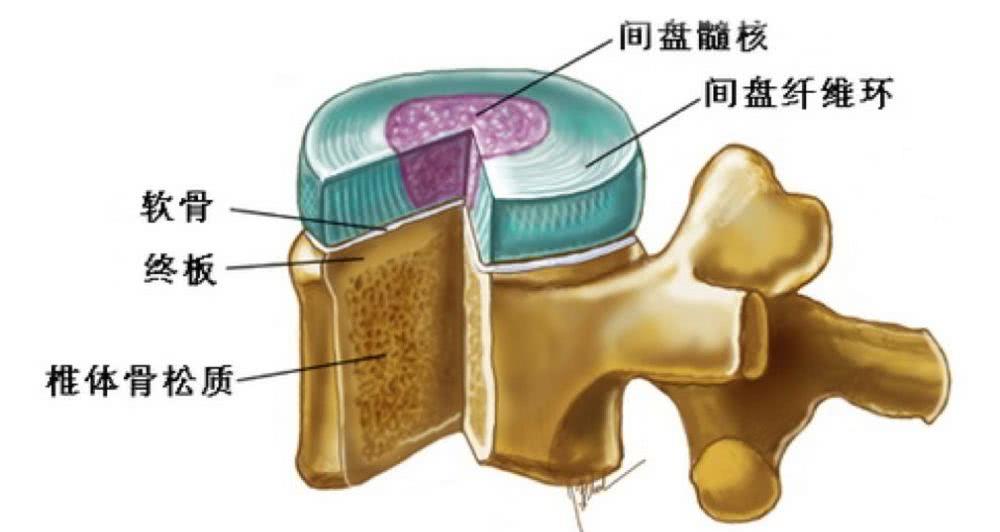 正常腰椎间盘后缘不超过椎体骨性终板的后缘,且中部略有凹陷呈肾形