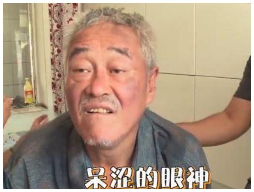 赵本山近照太揪心,动作缓慢全身邋遢,小品之王成癫疯老人?