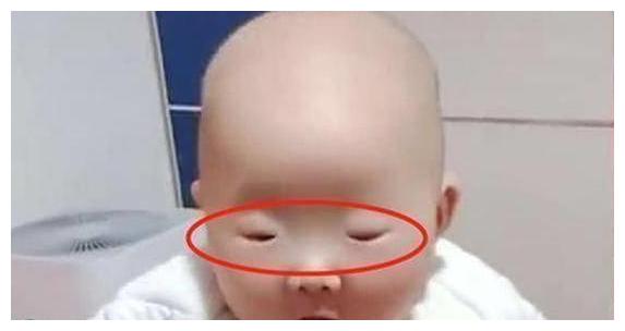 大眼睛夫妻生下缝眼宝宝奶奶安慰会张开一年后事情尴尬了