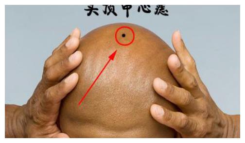 头顶长痣,长寿多金,福泽子孙,一代更比一代强__财经头条