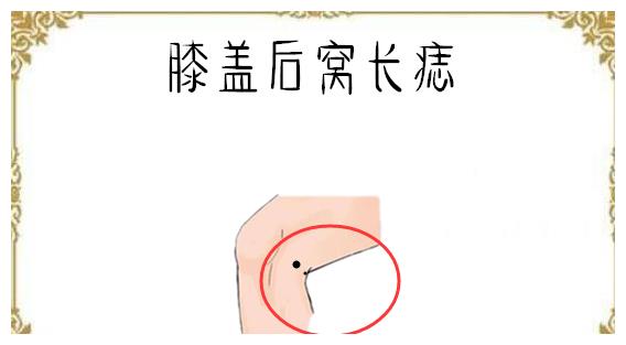 膝盖后窝长痣通常长在膝盖后窝位置的痣很难可以看得生肖性格出来