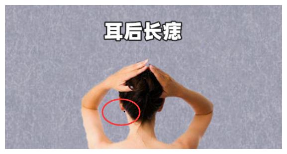 耳后长痣在相学当中,若是一个人的耳朵后面的位置处长有吉痣,则一般