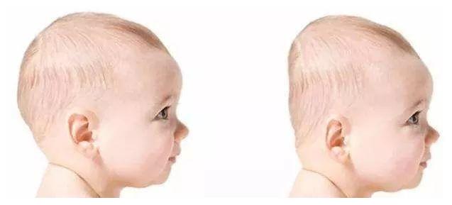 我这个头型属于扁头吗？