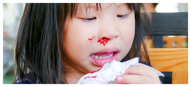 女儿突然流鼻血,妈妈让仰头,结果孩子送医院,医生:幸亏送及时