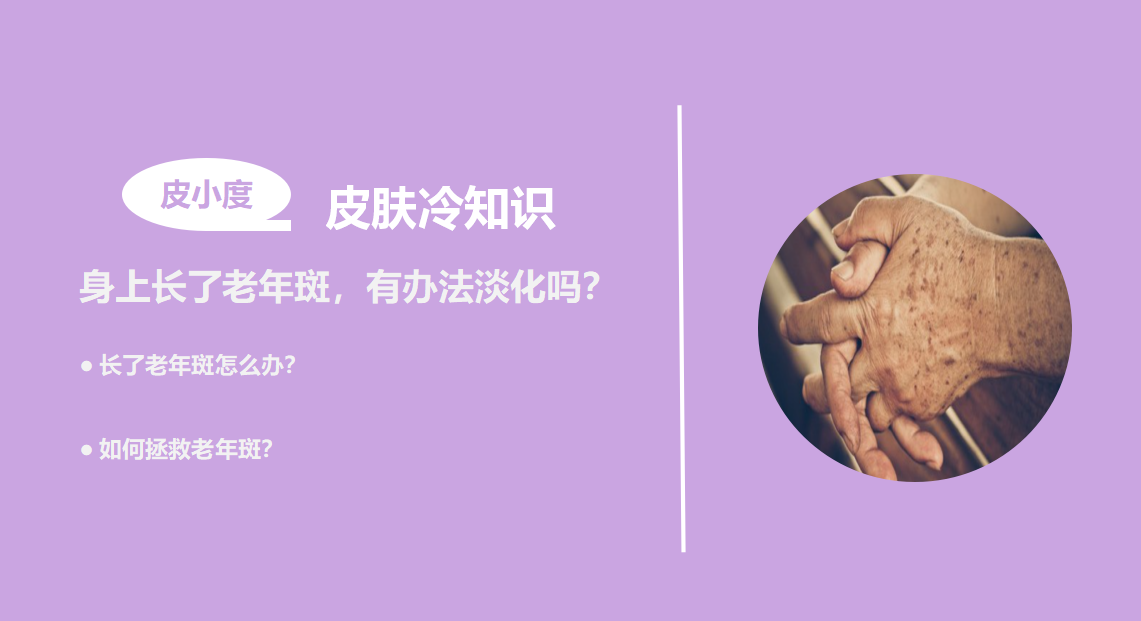 手上长了老年斑怎么办（手上长老年斑应该怎么办）-85模板网