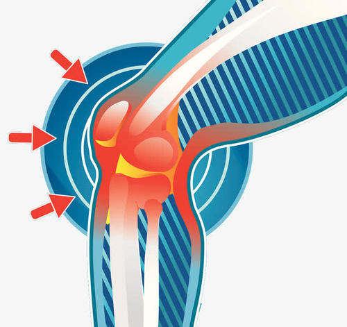 膝关节置换术三个阶段功能煅练,快get起来