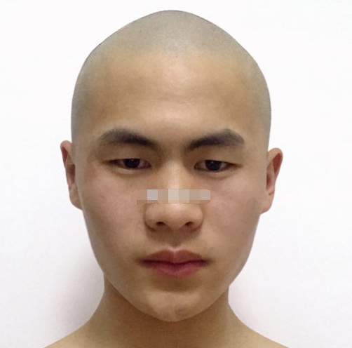 头尖饱满意味着有福,但头尖而瘦削却往往意味着无福.