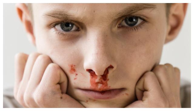 女儿突然流鼻血,妈妈让仰头,结果孩子送医院,医生:幸亏送及时