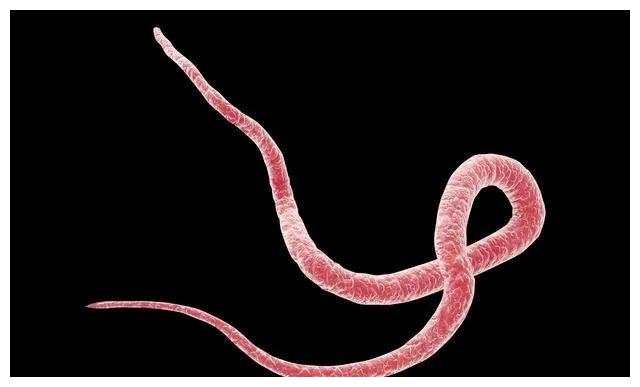 若孩子肚子里有蛔虫,会出现这些"信号",家长速查你家娃有吗?