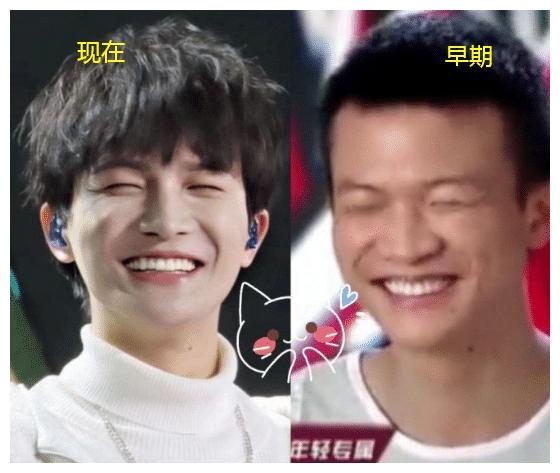 周深究竟有没有整容?3张图足以说明一切,这才是真相