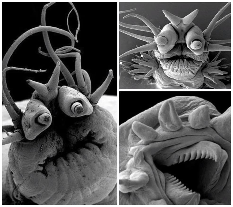 鸡皮疙瘩在显微镜下的图片(鸡皮疙瘩在显微镜下的图片是什么) 鸡皮疙瘩在显微镜下的图片(鸡皮疙瘩在显微镜下的图片是什么)