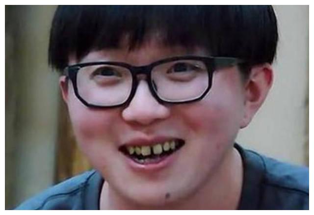 整牙后帅到认不出,终于相信baby的话|毛不易|整容|牙齿_新浪新闻