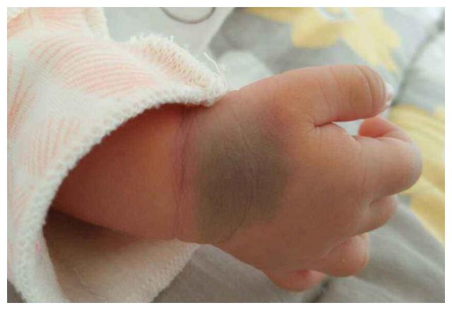 刚出生的宝宝若有4种特征说明你家孩子发育的很好恭喜了