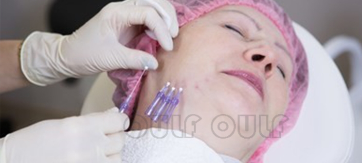 分析:做线雕的最佳年龄是多少?做完线雕脸上有凹陷多久会恢复?休闲区蓝鸢梦想 - Www.slyday.coM 分析:做线雕的最佳年龄是多少?做完线雕脸上有凹陷多久会恢复?休闲区蓝鸢梦想 - Www.slyday.coM