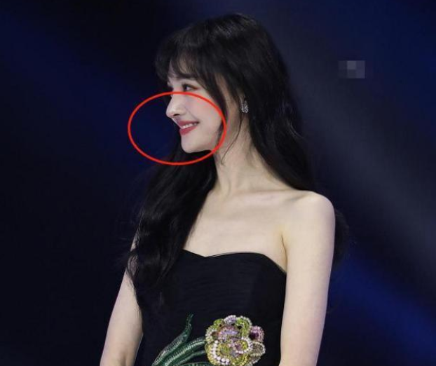 郑爽取出鼻子假体?从"格格巫"变成了小仙女!