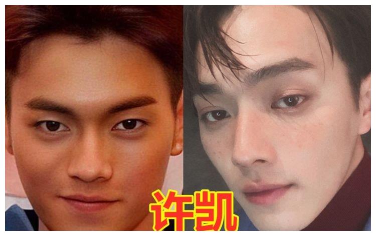 明星"割双眼皮前vs后",许凯变化认不出,戚薇美出新高度!