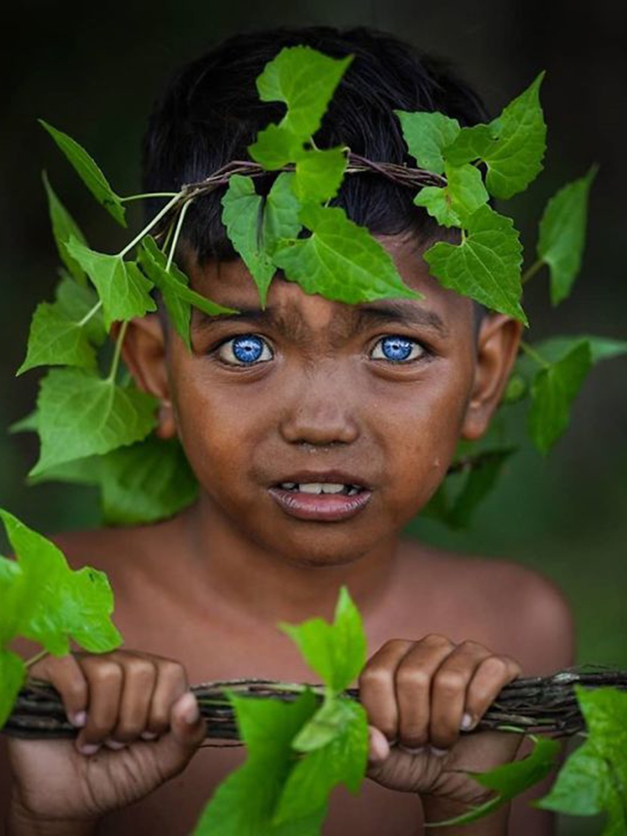 他们是亚洲人却被称蓝精灵天生拥有蓝眼睛背后故事让人无奈